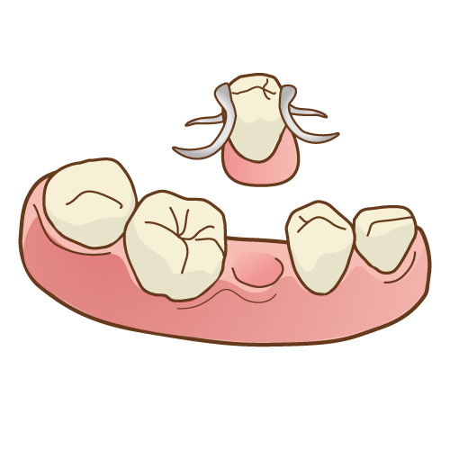 歯が無くなったらどうする？