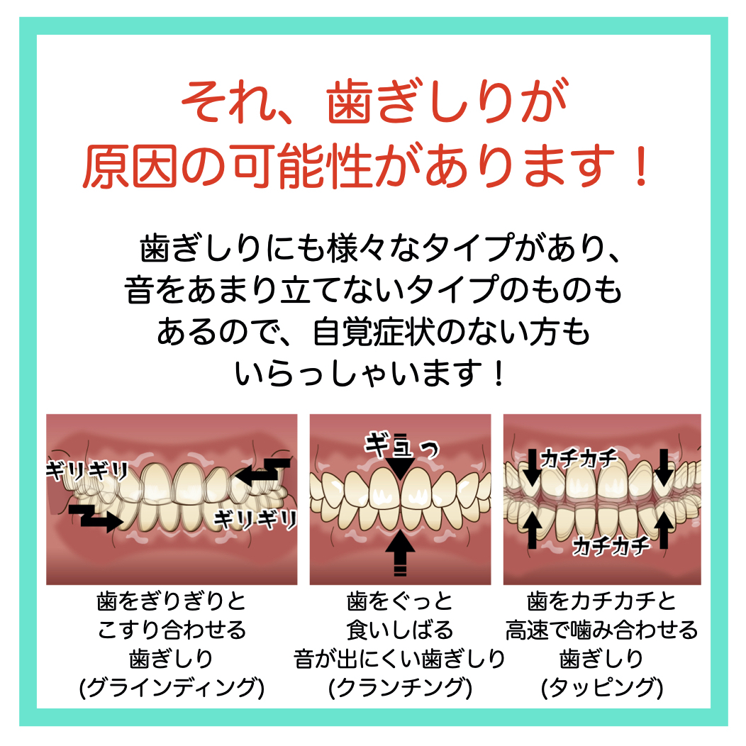 歯を守るマウスピース