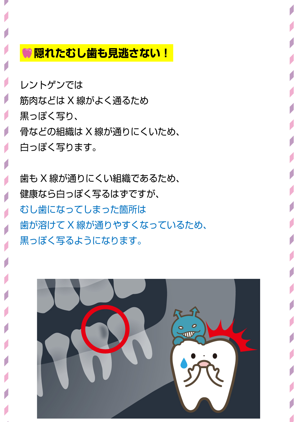 こんなことまで全部見える！レントゲンでわかること